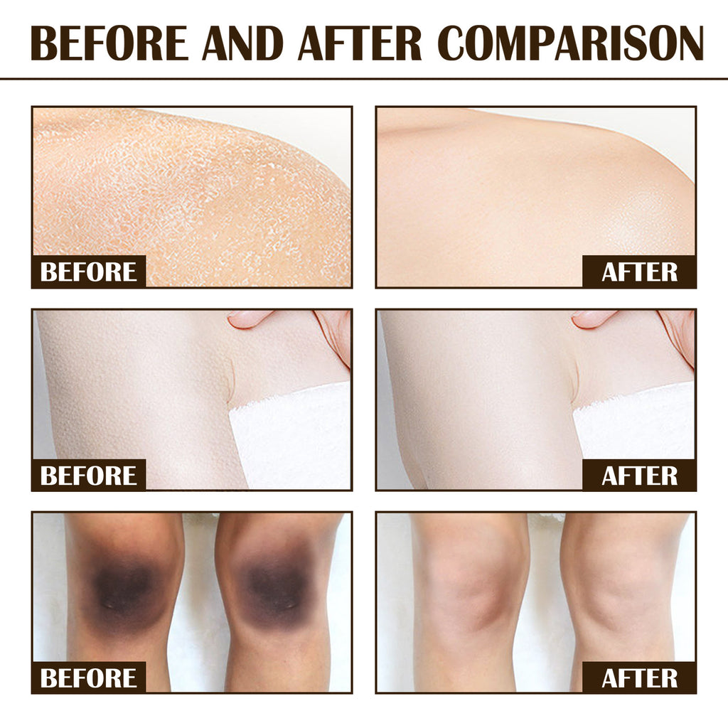 Melanin Brightening And Whitening Body Skin Coffee Scrub