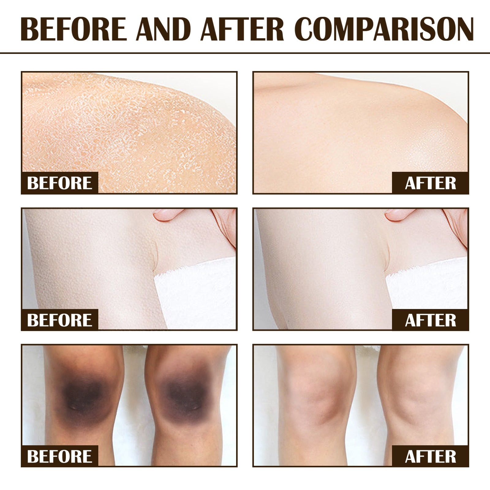 Melanin Brightening And Whitening Body Skin Coffee Scrub