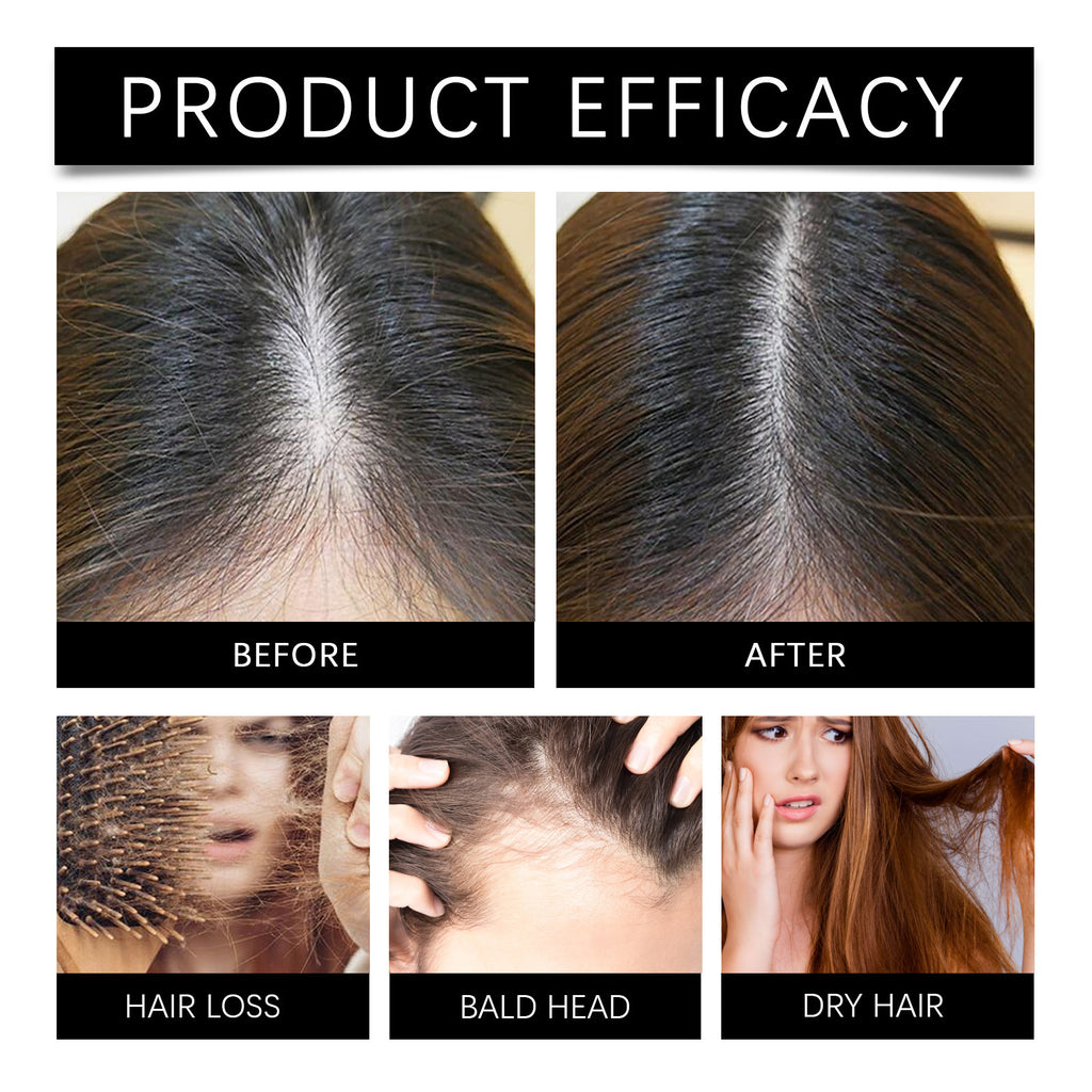 Marjoran Mi Hair Oil Moisture Replenishment Hair Essence For Repairing Dry And Manic Hair